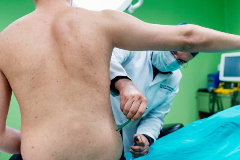 Abdominoplastia Homem Clínica Cidade dos Colibris - Abdominoplastia Masculina