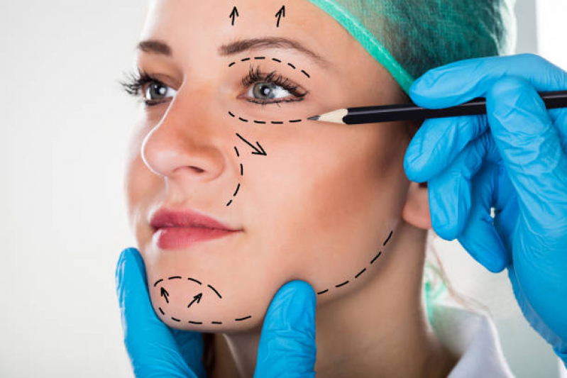 Cirurgia de Perfiloplastia para Correção Clínica São Bento - Cirurgia de Perfiloplastia para Harmonia Facial