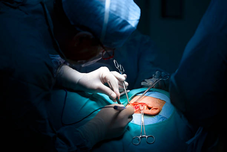 Cirurgia para Correção de Orelha de Abano Marcar Distrito Mecânico - Cirurgia de Redução de Orelha