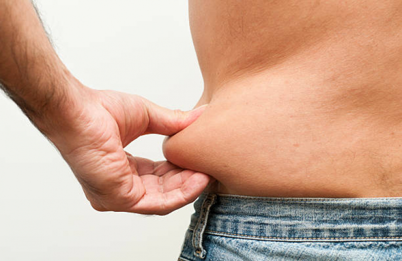 Contorno Corporal para Homens Ernani Sátiro - Contorno Corporal para Excesso de Gordura