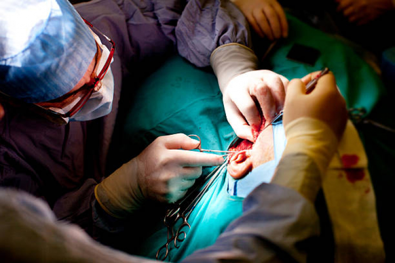 Onde Fazer Cirurgia para Correção de Orelha de Abano Roger - Cirurgia Plástica na Orelha
