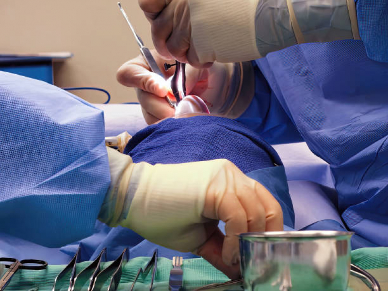 Onde Fazer Cirurgia para Nariz Serra Redonda - Cirurgia de Rinoplastia Masculina