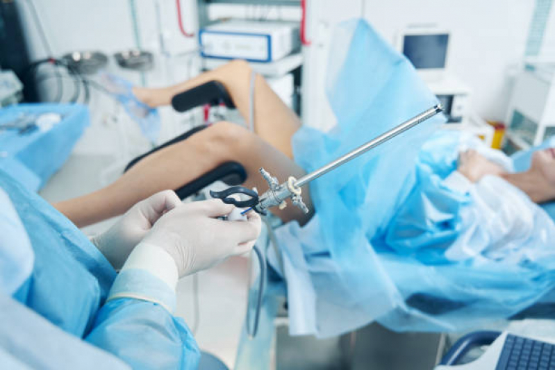 Onde Fazer Cirurgia Pequenos Lábios Tambauzinho - Cirurgia de Ninfoplastia a Laser