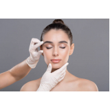 cirurgia de perfiloplastia para harmonia facial Estrada Cabedelha