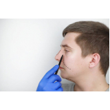 cirurgia nariz marcar Cuia