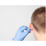 cirurgia plástica na orelha Pombal