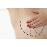 mamoplastia de redução das mamas marcar Matinhas