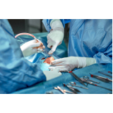 onde fazer cirurgia rinoplastia Expedicionários